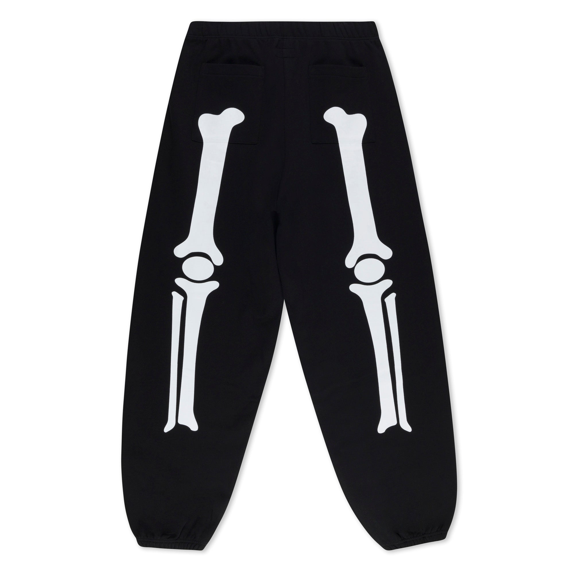 RIPNDIP Skelly Nerm Sweatpants (Black)